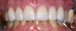 Marin Dentistry Before & After