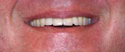 Marin Dentistry Before & After