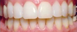 Marin Dentistry Before & After