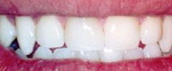 Marin Dentistry Before & After