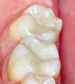 Marin Dentistry Before & After