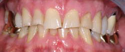 Marin Dentistry Before & After