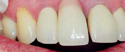 Marin Dentistry Before & After