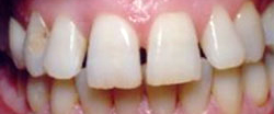 Marin Dentistry Before & After