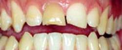 Marin Dentistry Before & After